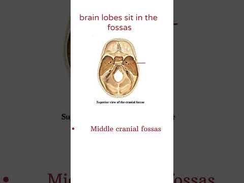 Skull X-Ray Quiz