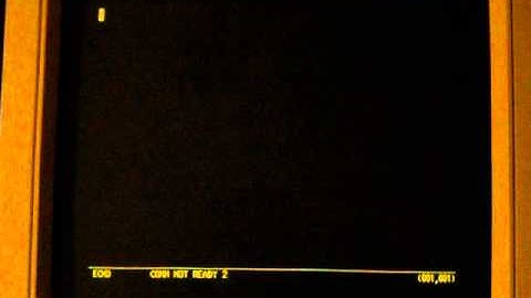 IBM PowerServer 230 - 22 - Restoring From Tape