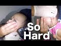 How to Remove Solid Hard Earwax Stuck in Girl&#39;s Ear