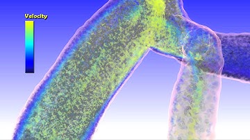 ScienceVisuals/Visualbiotech - "Computational Multiscale Hemodynamics"