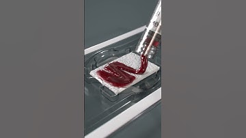 MagnetOs™ Flex Matrix | Medical Animation