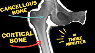 Cortical bone 🦴 Vs Cancellous bone 🦴 | In Three minutes