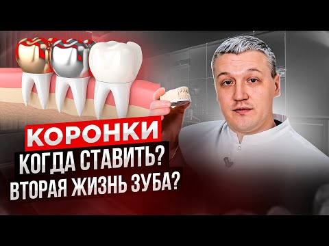 🦷🤔Коронки: ГРОБ для зубов или вторая жизнь? Когда пора устанавливать? Какие выбрать?😊🦷