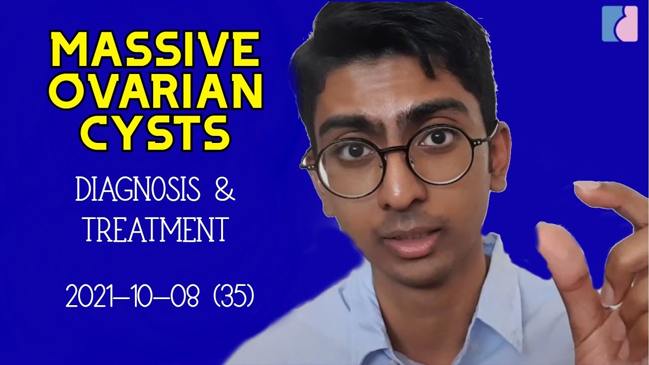 Massive Ovarian Cysts How we treat this condition YouTube