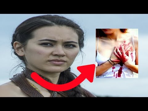 jessica-henwick-actress-of-games-of-thrones-got-attacked-in-real-life