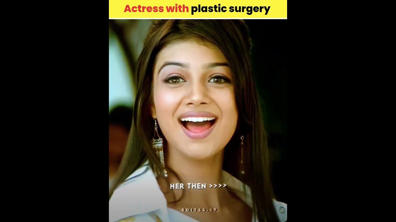 Actress with plastic surgery | #shorts #factwood Actress with plastic surgery | #shorts #factwood