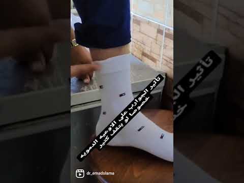 تأثير الشرابات الجوارب علي الاوعيه الدمويه والشرايين في القدم
