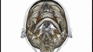 Soft Tissue & Bone - 3D Cone Beam CT Scan and Animation by SmartScan Imaging of Orange