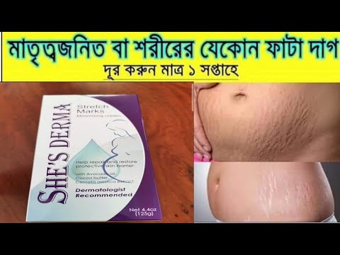 ভিডিও: মিসপে মানে কি?