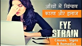 Eye Strain Causes, Signs & Treatment | Easy Tips to cure Eye strain आँखों में खिंचाव  कारण और इलाज