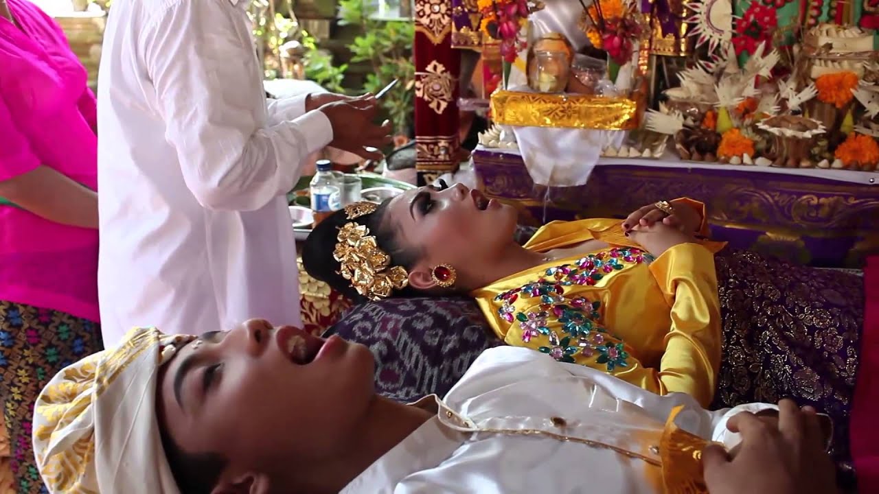 Potong Gigi - Traditional Tooth Peeling Ceremony on the Island of Gods ...
