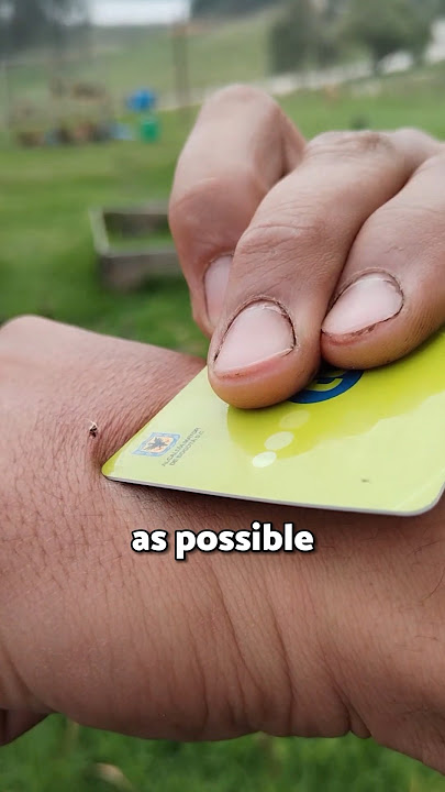 How to SURVIVE a bee attack 👏 #viral