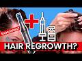 Scalp Microneedling + Exosome Injections for Hair Growth 💉 Hair Luma Results