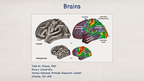 Exploring The Human-Ape Paradox: Todd Preuss - Brains