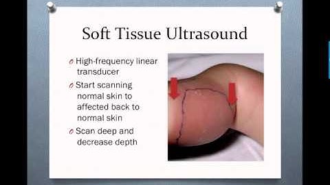 Soft Tissue Ultrasound Case Based MS3 Video