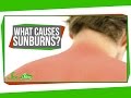 What Causes Sunburns?