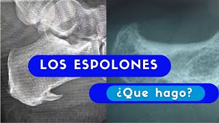 Espolones en los pies ¿Por qué salen?