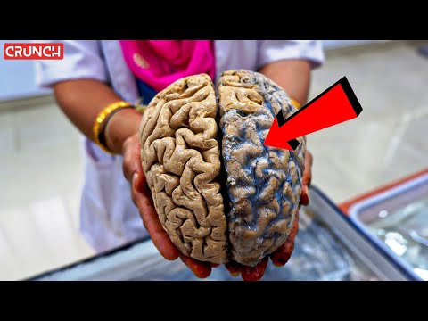 मानव मस्तिष्क यादों और सूचनाओं को कैसे संग्रहीत करता है?