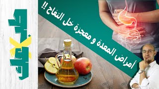 حمض المعدة و خل التفاح | طب ولا عك؟ | قرحة المعدة | ارتجاع المريء | عسر الهضم | العلاج الحقيقي