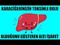 Karaciğerinizin Toksinle Dolu Olduğunu Gösteren Altı İşaret