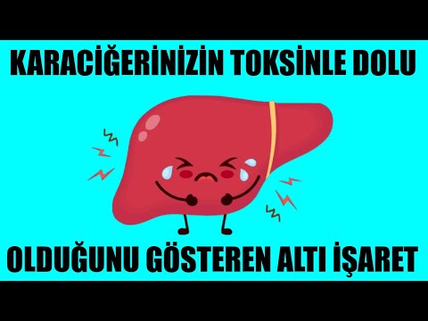 karaciğerinizin toksinle dolu olduğunu gösteren altı i̇şaret