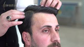 Nimetullah Binay Saç Ekim Sonucumuz!