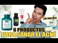 6 Productos para Sanar El Acné De Una Vez