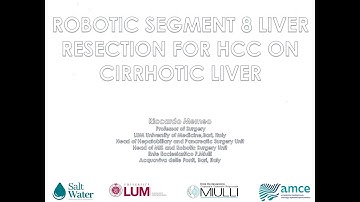 Segment 8 robotic liver resection for HCC in cirrhotic liver
