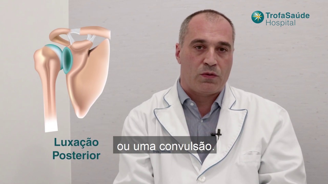 Luxação do Ombro YouTube Luxação do Ombro YouTube