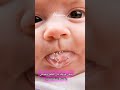 سيلان اللعاب عند الرضع 