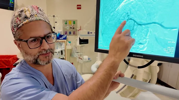 Radioembolization for Liver Cancer with Dr. Juan Rodriguez