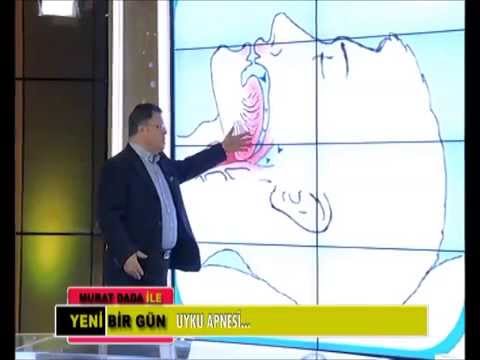 HORLAMA, APNE, UYKUDA TIKANMA, NEFESSİZ KALMA TEDAVİ VE ÇÖZÜMLER