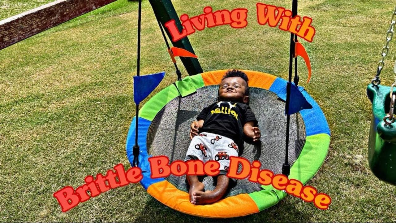 LIVING WITH BRITTLE BONE DISEASE .. YouTube