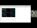 Microglial-mediated-phagocytosis underlies.... presentation by Lara Rogerson-Wood