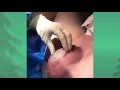 Normal hospital birth giving birth at the hospital