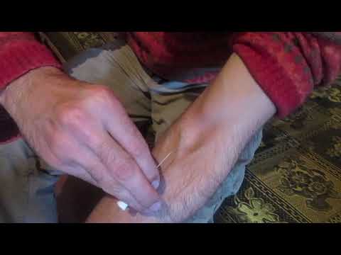 როგორ დავიდგათ გადასხმის სისტემა!