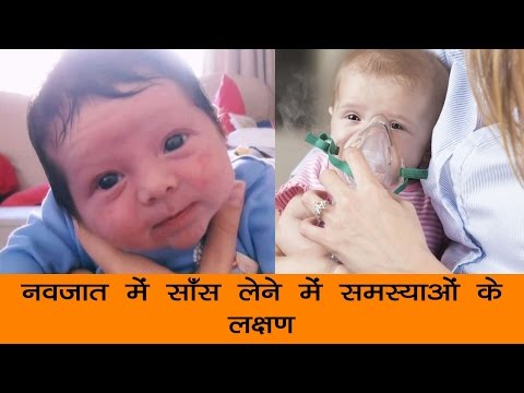 वीडियो: क्या शिशु की सांस आपकी त्वचा के लिए खराब है - जानें बच्चे की सांस के रैश उपचार के बारे में