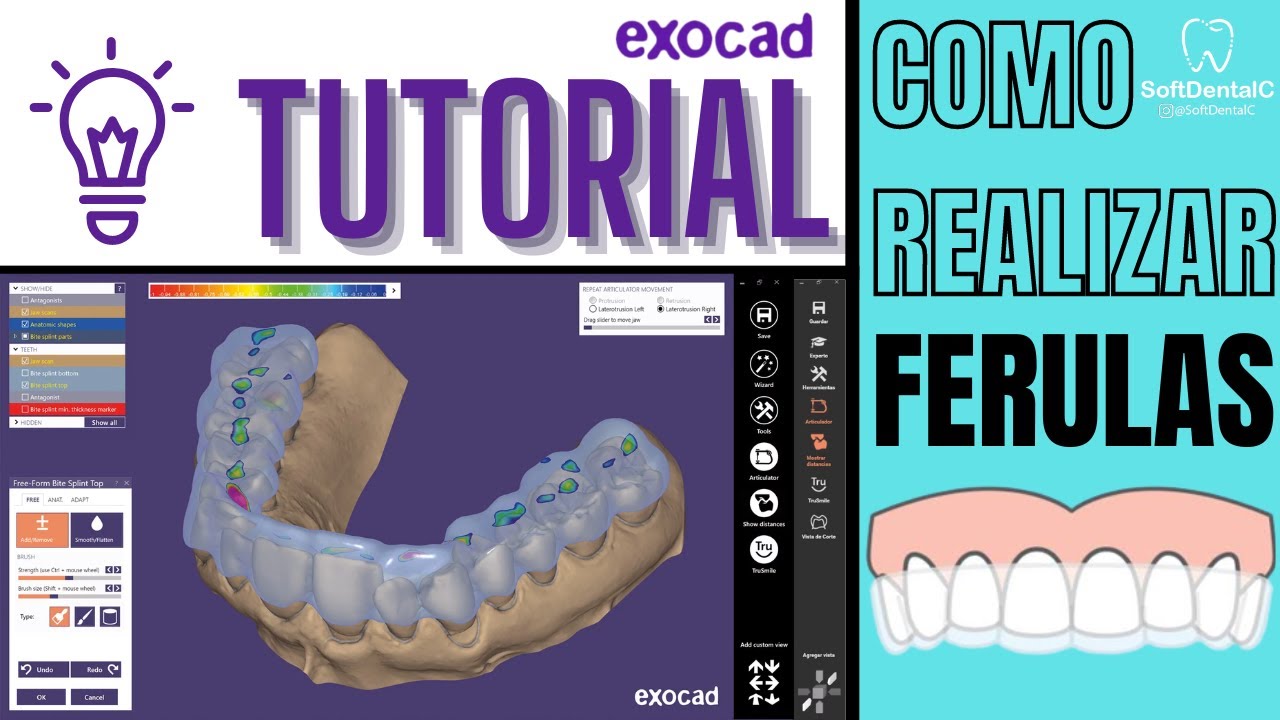 COMO REALIZAR FERULAS EN #EXOCAD 🔥¡TUTORIAL SOFTDENTALC!