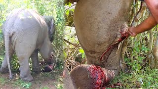 Abscess Popped from Elephant&#39;s Leg ,Timely Treatment from Kind Humans Made Him Live Again