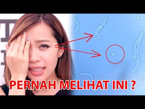 Video: Garis Penglihatan