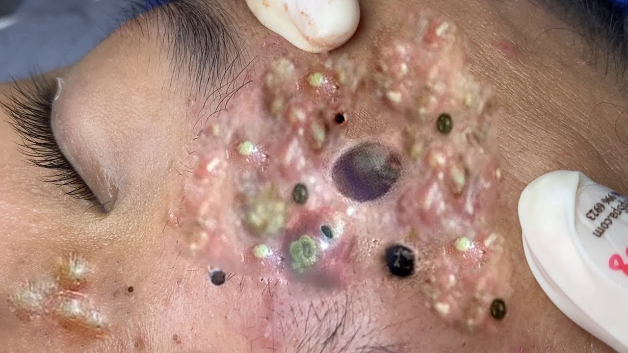 𝑺𝒐𝒐𝒕𝒉𝒊𝒏𝒈 𝑭𝒂𝒄𝒊𝒂𝒍 𝑻𝒓𝒆𝒂𝒕𝒎𝒆𝒏𝒕 𝒇𝒐𝒓 𝑺𝒕𝒓𝒆𝒔𝒔 𝑹𝒆𝒍𝒊𝒆𝒇 | 𝑫𝒆𝒆𝒑 𝑪𝒍𝒆𝒂𝒏𝒊𝒏𝒈 & 𝑪𝒂𝒍𝒎𝒊𝒏𝒈 𝑴𝒂𝒔𝒔𝒂𝒈𝒆 𝒂𝒕 𝑳𝒖𝒙𝒖𝒓𝒚 𝑺𝒑𝒂 #887613