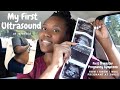 My First Ultrasound Appt | How I knew I was pregnant at 3 weeks? + My First Trimester Symptoms etc.