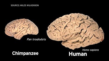 Scientists examine genetic origins of the human brain