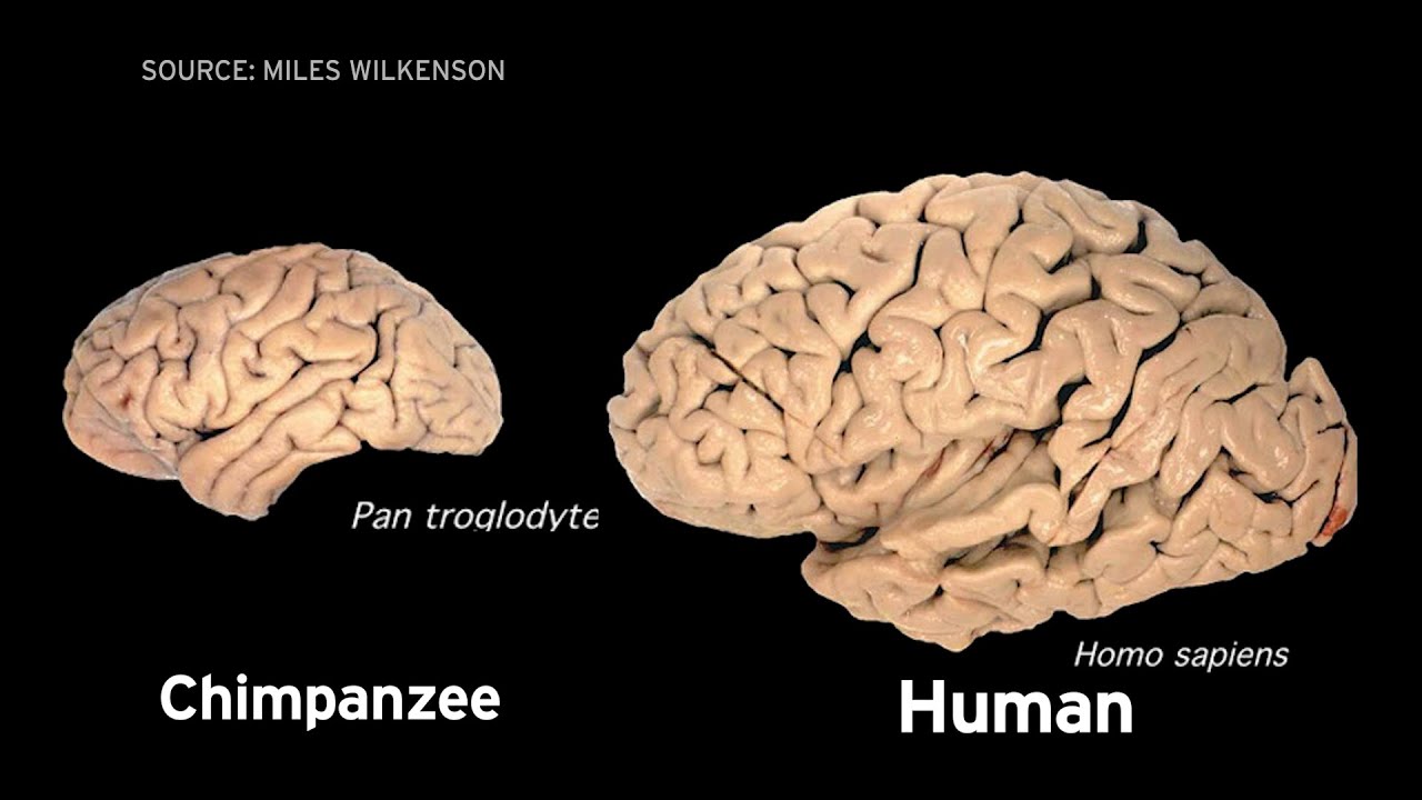 Scientists examine genetic origins of the human brain - YouTube