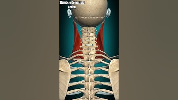 Sternocleidomastoid 3D Animation video