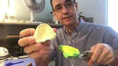Como remover alginato?