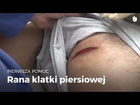 Wideo: Ssanie Rany W Klatce Piersiowej: Pierwsza Pomoc, Leczenie I Powrót Do Zdrowia