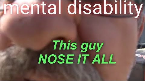 This Guy Needs A NOSE JOB BADLY.. WHAT WOULD YOU DO?