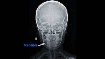 ☢️skull x ray positioning ap🫴#radiology #xray #radiation #shorts #trending#subscribers