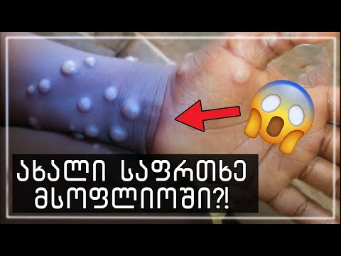 ახალი ვირუსი ვრცელდება?!🔴(შეთქმულების თეორია)